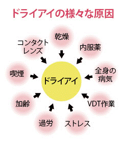 ドライアイの原因