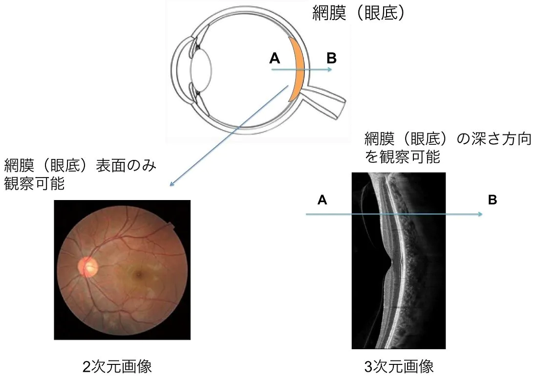 3次元眼底像撮影装置　DRI OCT Triton plus