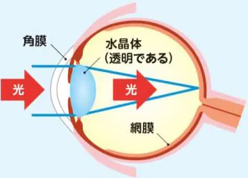 健康な目