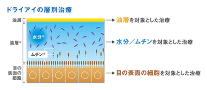 ドライアイの層別治療