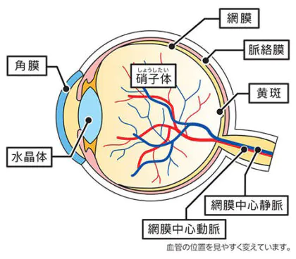 網膜静脈閉塞症