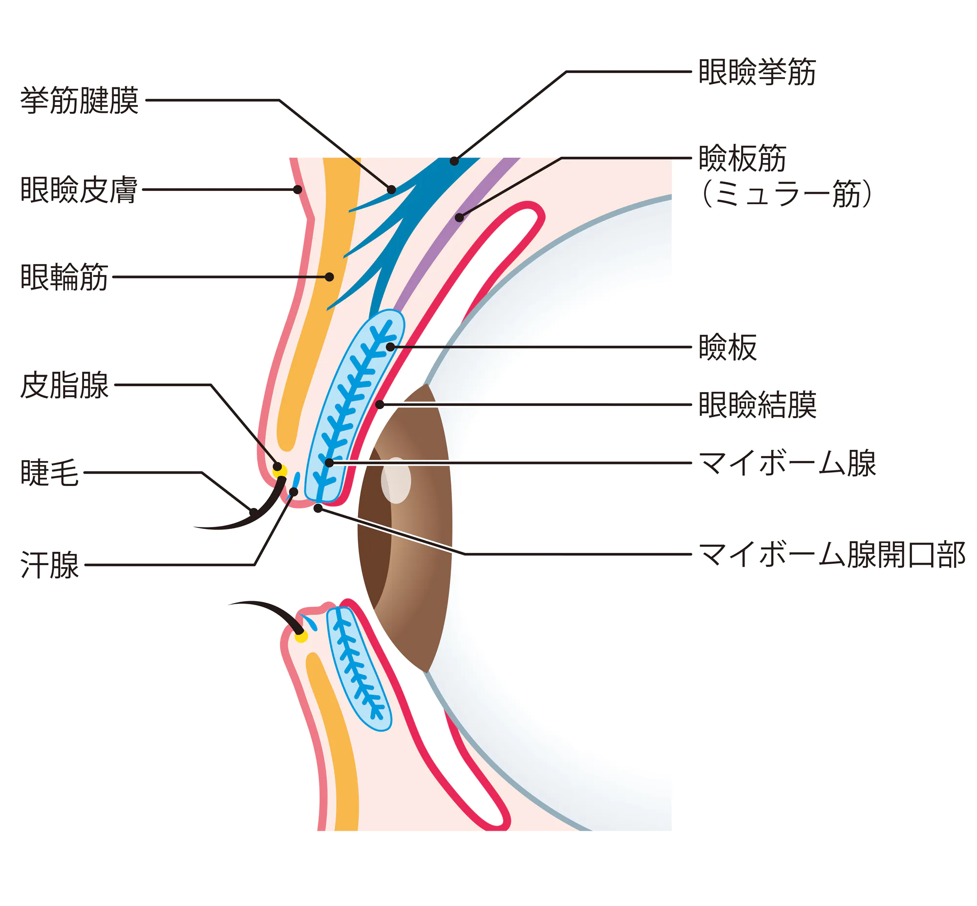 眼瞼炎（マイボーム腺機能不全MGD）とは